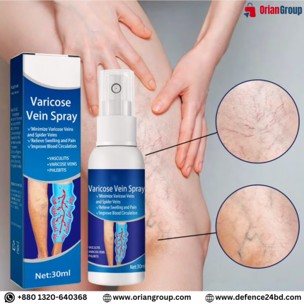 Varicose Veins Spray Medicine Spider Veins Relief Vasculitis Phlebitis Spider Pain Relief Plaster Care 30ml