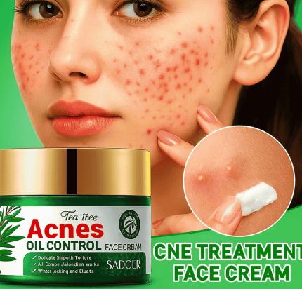 Tea Tree Acnes Oil Control Face Cream | Acne Treatment & Oil-Free Skin Solution